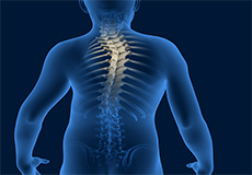 Spine Deformity Surgery